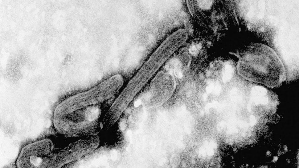 An electron micrograph of the Marburg virus. In black and white, two rod-shaped viruses can be seen, bent at one end.