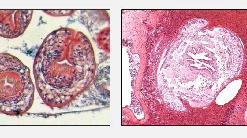 Erregernachweis im Gewebe: Mikroskopisch sichtbare Parasiten(bestandteile)  [links: Kopfanlagen des dreigliedrigen Hundebandwurms (Echninococcus granulosus);  mitte: Zungenwurm (Armillifer armillatus) Querschnitt;  rechts: Fadenwurm (Halicephalobus) im Gehirn]