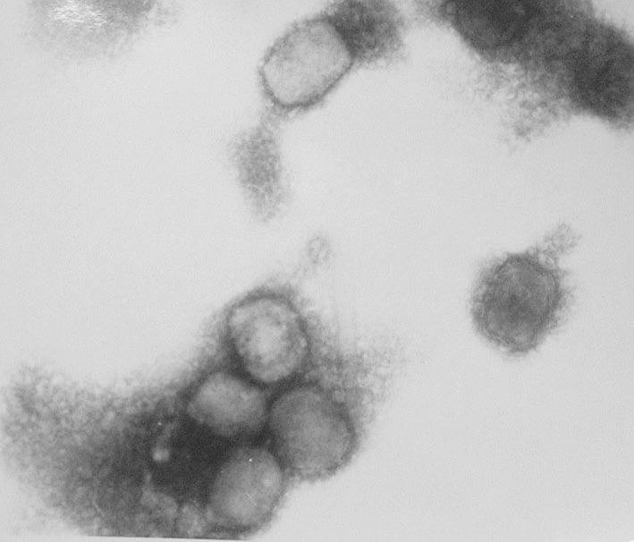 Elektronenmikroskopisches Bild von Mpox-Viren